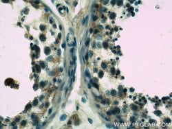 WDR7 Rabbit anti-Human, Mouse, Rat, Polyclonal, Proteintech 150 &mu;L | Buy Online | Proteintech Group Inc | Fisher Scientific