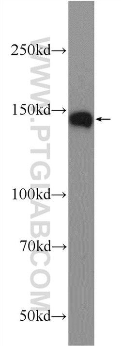 WDR7 Rabbit anti-Human, Mouse, Rat, Polyclonal, Proteintech 150 &mu;L | Buy Online | Proteintech Group Inc | Fisher Scientific