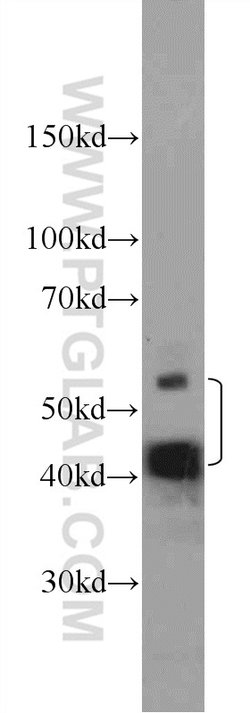 LYAR Rabbit anti-Human, Mouse, Polyclonal, Proteintech:  