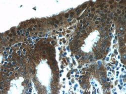 NUP205 Rabbit anti-Human, Polyclonal, Proteintech 150 &mu;L; Unconjugated:Antibodies,