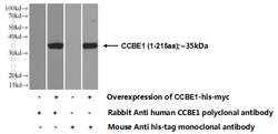 CCBE1 Rabbit anti-Human, Polyclonal, Proteintech 150 &mu;L; Unconjugated:Antibodies,