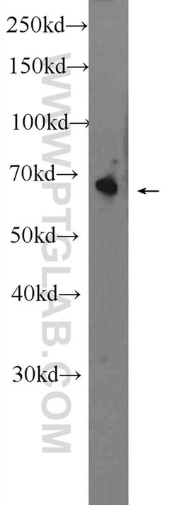 OTOP1 Rabbit anti-Human, Mouse, Polyclonal, Proteintech:Antibodies:Primary