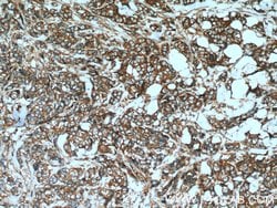 GEF-H1 Rabbit anti-Human, Polyclonal, Proteintech 20 &mu;L; Unconjugated:Antibodies,