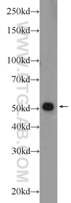 TMEM194A Rabbit anti-Human, Mouse, Polyclonal, Proteintech 150 &mu;L; Unconjugated:Antibodies,