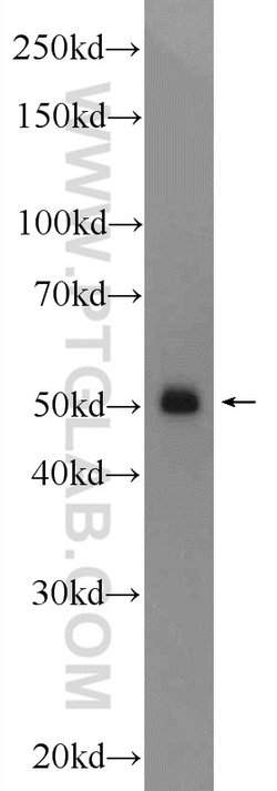 TMEM194A Rabbit anti-Human, Mouse, Polyclonal, Proteintech 150 &mu;L; Unconjugated:Antibodies,