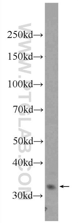 AMZ1 Rabbit anti-Human, Mouse, Rat, Polyclonal, Proteintech 150 μL;