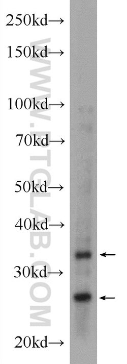 AMZ1 Rabbit anti-Human, Mouse, Rat, Polyclonal, Proteintech 150 μL;
