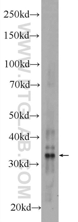 AMZ1 Rabbit anti-Human, Mouse, Rat, Polyclonal, Proteintech 150 μL;