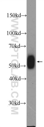 Thumbnail_LCK Rabbit anti-Human, Mouse, Polyclonal, Proteintech 150 &mu;L; Unconjugated:Antibodies,