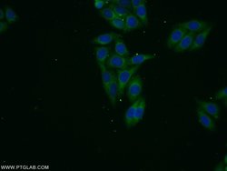 VPS13B Rabbit anti-Human, Mouse, Polyclonal, Proteintech 150 &mu;L; Unconjugated:Antibodies,