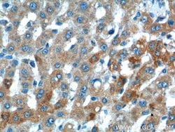 VPS13B Rabbit anti-Human, Mouse, Polyclonal, Proteintech 150 &mu;L; Unconjugated:Antibodies,