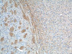 VPS13B Rabbit anti-Human, Mouse, Polyclonal, Proteintech 150 &mu;L; Unconjugated:Antibodies,