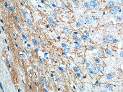 VPS13B Rabbit anti-Human, Mouse, Polyclonal, Proteintech 150 &mu;L; Unconjugated:Antibodies,