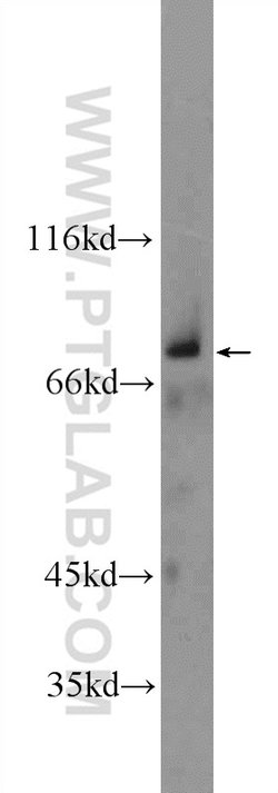 ZNF512 Rabbit anti-Human, Mouse, Polyclonal, Proteintech 150 &mu;L; Unconjugated:Antibodies,