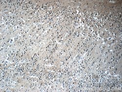 FBXO41 Rabbit anti-Human, Mouse, Rat, Polyclonal, Proteintech:Antibodies:Primary