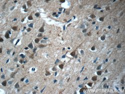 FBXO41 Rabbit anti-Human, Mouse, Rat, Polyclonal, Proteintech:Antibodies:Primary