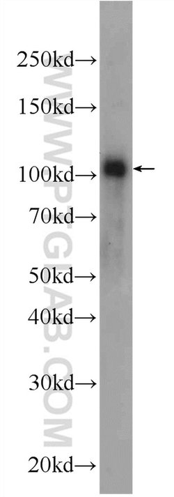 FBXO41 Rabbit anti-Human, Mouse, Rat, Polyclonal, Proteintech:Antibodies:Primary