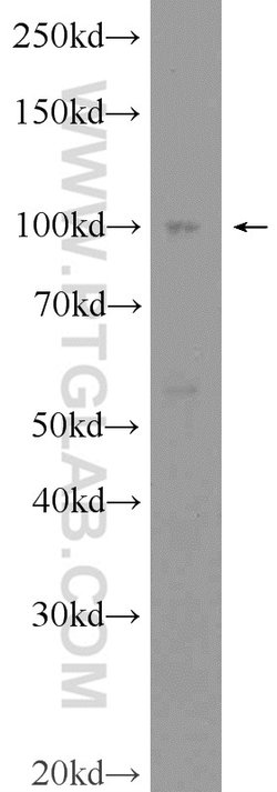FBXO41 Rabbit anti-Human, Mouse, Rat, Polyclonal, Proteintech:Antibodies:Primary
