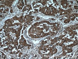 C10orf125 Rabbit anti-Human, Polyclonal, Proteintech:Antibodies:Primary