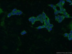 ZBTB8A Rabbit anti-Human, Polyclonal, Proteintech 150 &mu;L | Buy Online | Proteintech Group Inc | Fisher Scientific