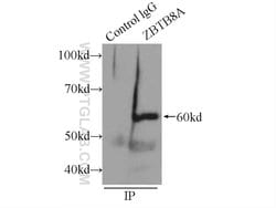 ZBTB8A Rabbit anti-Human, Polyclonal, Proteintech 150 &mu;L | Buy Online | Proteintech Group Inc | Fisher Scientific