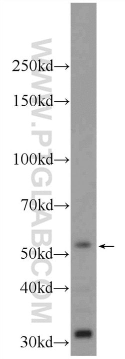 ZBTB8A Rabbit anti-Human, Polyclonal, Proteintech 150 &mu;L | Buy Online | Proteintech Group Inc | Fisher Scientific