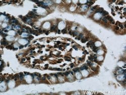 C8orf77 Rabbit anti-Human, Polyclonal, Proteintech:Antibodies:Primary Antibodies