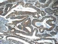 C8orf77 Rabbit anti-Human, Polyclonal, Proteintech:Antibodies:Primary Antibodies