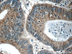 C8orf77 Rabbit anti-Human, Polyclonal, Proteintech:Antibodies:Primary Antibodies