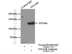 CD41/Integrin alpha 2b Rabbit anti-Human, Mouse, Rat, Polyclonal, Proteintech