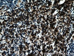 CD41/Integrin alpha 2b Rabbit anti-Human, Mouse, Rat, Polyclonal, Proteintech