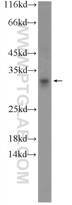 C15orf53 Rabbit anti-Human, Polyclonal, Proteintech 150 μL; Unconjugated:Antibodies,