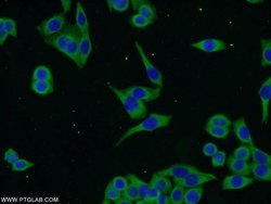 ENTPD7 Rabbit anti-Human, Polyclonal, Proteintech 150 &mu;L; Unconjugated:Antibodies,