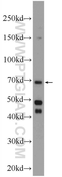 ENTPD7 Rabbit anti-Human, Polyclonal, Proteintech 150 &mu;L; Unconjugated:Antibodies,