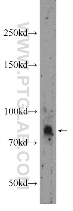 USP35 Rabbit anti-Human, Polyclonal, Proteintech:Antibodies:Primary Antibodies