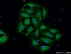 MYO10 Rabbit anti-Human, Mouse, Polyclonal, Proteintech 150 &mu;L; Unconjugated:Antibodies,