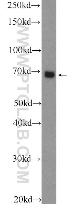PTPN11 Rabbit anti-Human, Polyclonal, Proteintech