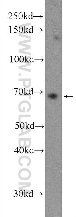 PTPN11 Rabbit anti-Human, Polyclonal, Proteintech:Anticorps:Anticorps primaires