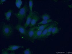 PTPN11 Rabbit anti-Human, Polyclonal, Proteintech:Anticorps:Anticorps primaires