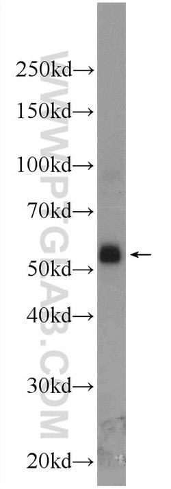 NR2F1 Rabbit anti-Human, Mouse, Polyclonal, Proteintech:Antibodies:Primary