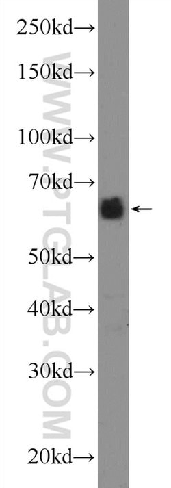 CCDC67 Rabbit anti-Human, Mouse, Polyclonal, Proteintech:Antibodies:Primary