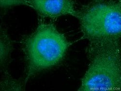 DSG1 Rabbit anti-Human, Polyclonal, Proteintech 20 &mu;L | Buy Online | Proteintech | Fisher Scientific