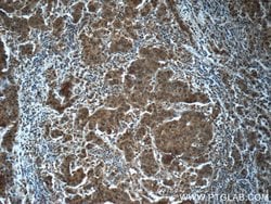 POTEA Rabbit anti-Human, Mouse, Polyclonal, Proteintech 150 &mu;L; Unconjugated:Antibodies,