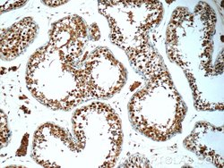 POTEA Rabbit anti-Human, Mouse, Polyclonal, Proteintech 150 &mu;L; Unconjugated:Antibodies,