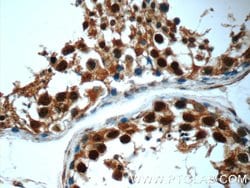 POTEA Rabbit anti-Human, Mouse, Polyclonal, Proteintech 150 &mu;L; Unconjugated:Antibodies,