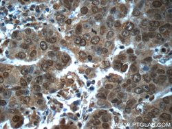 POTEA Rabbit anti-Human, Mouse, Polyclonal, Proteintech 150 &mu;L; Unconjugated:Antibodies,