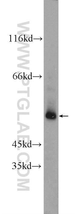 POTEA Rabbit anti-Human, Mouse, Polyclonal, Proteintech 150 &mu;L; Unconjugated:Antibodies,