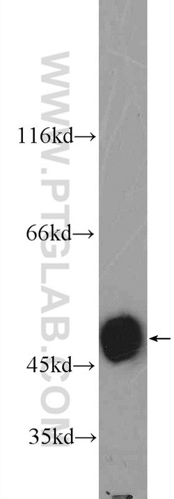 POTEA Rabbit anti-Human, Mouse, Polyclonal, Proteintech 150 &mu;L; Unconjugated:Antibodies,