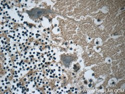 RAB3GAP2 Rabbit anti-Human, Mouse, Rat, Polyclonal, Proteintech:Antibodies:Primary