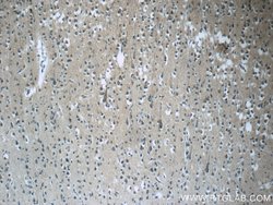RAB3GAP2 Rabbit anti-Human, Mouse, Rat, Polyclonal, Proteintech:Antibodies:Primary